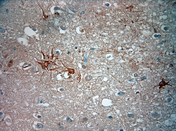 ASIC3 Antibody in Immunohistochemistry (Paraffin) (IHC (P))