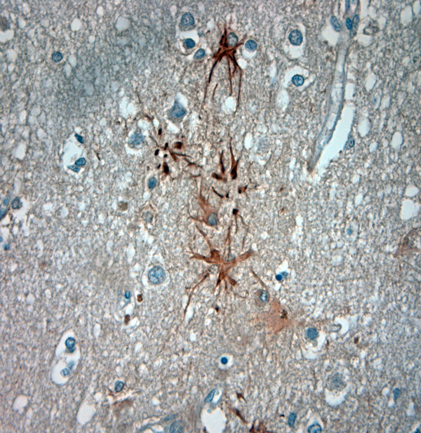 ASIC3 Antibody in Immunohistochemistry (Paraffin) (IHC (P))