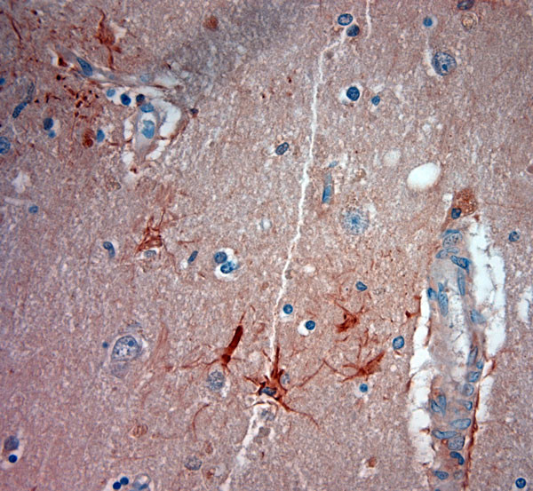 ASIC3 Antibody in Immunohistochemistry (Paraffin) (IHC (P))