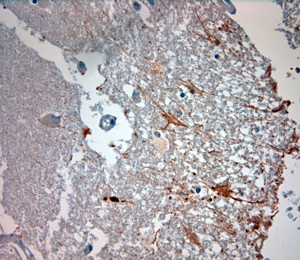 ASIC3 Antibody in Immunohistochemistry (Paraffin) (IHC (P))