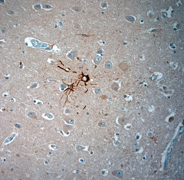 ASIC3 Antibody in Immunohistochemistry (Paraffin) (IHC (P))