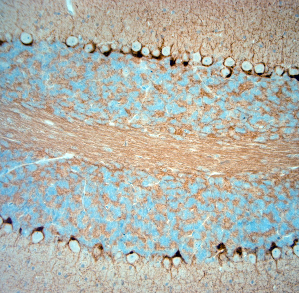 HCN1 Antibody in Immunohistochemistry (Paraffin) (IHC (P))