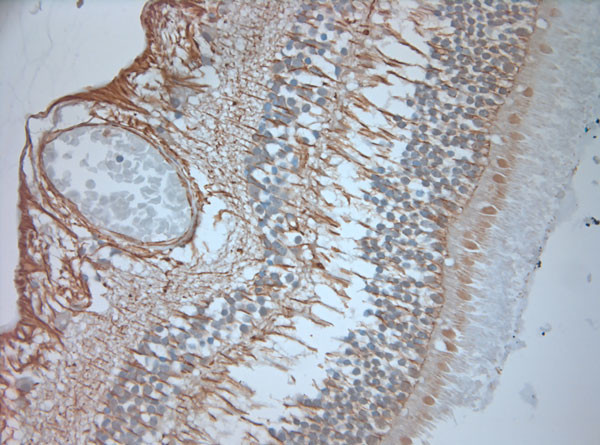 OA1 Antibody in Immunohistochemistry (Paraffin) (IHC (P))