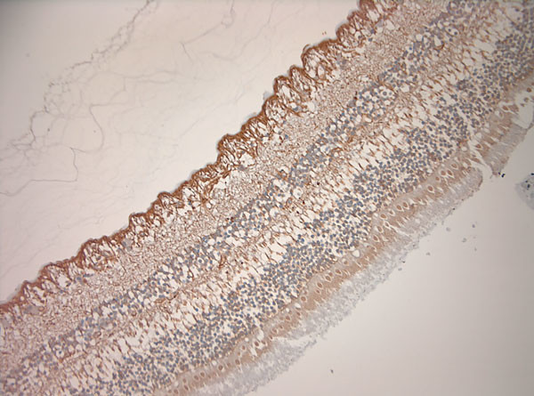 OA1 Antibody in Immunohistochemistry (Paraffin) (IHC (P))