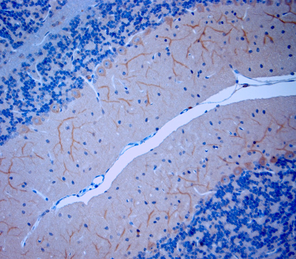 TRPV2 Antibody in Immunohistochemistry (Paraffin) (IHC (P))