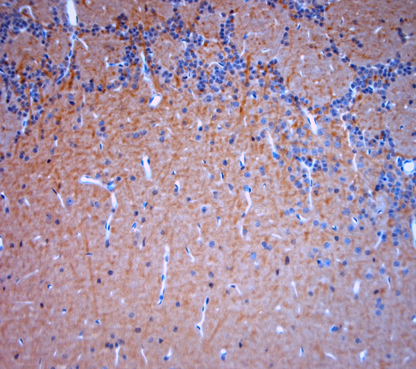 TRPV2 Antibody in Immunohistochemistry (Paraffin) (IHC (P))