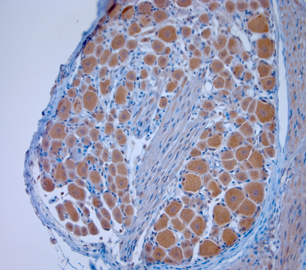 TRPV2 Antibody in Immunohistochemistry (Paraffin) (IHC (P))