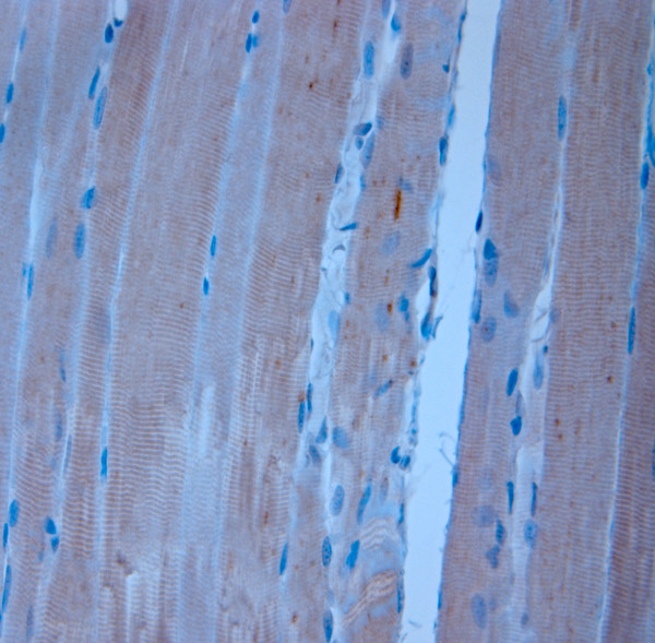 TRPV2 Antibody in Immunohistochemistry (Paraffin) (IHC (P))