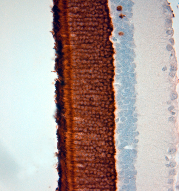 Rhodopsin Antibody in Immunohistochemistry (Paraffin) (IHC (P))