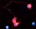 Rabphilin-3A Antibody in Immunocytochemistry (ICC/IF)