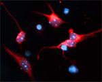 Rabphilin-3A Antibody in Immunocytochemistry (ICC/IF)