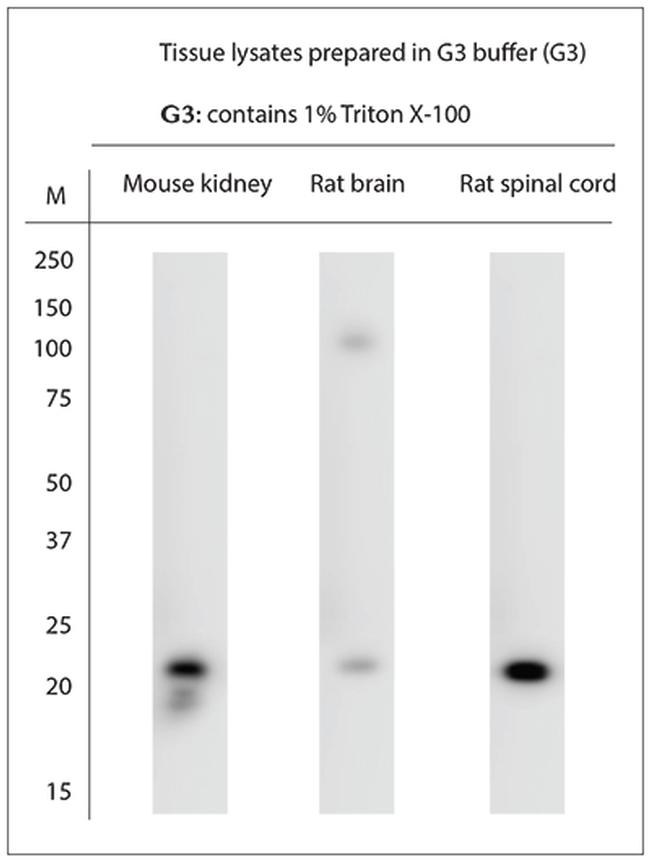 RAC1, RAC2 Antibody in Western Blot (WB)