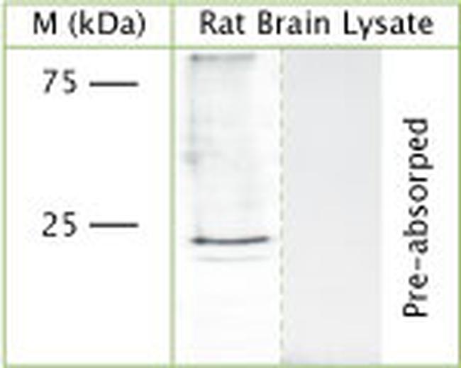 RAB5A Antibody in Western Blot (WB)