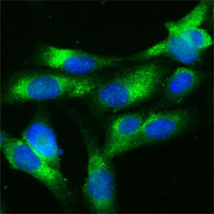 RAB7 Antibody in Immunocytochemistry (ICC/IF)