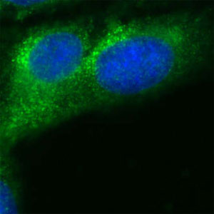 RAB7 Antibody in Immunocytochemistry (ICC/IF)