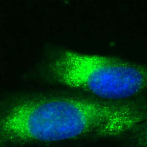 RAB7 Antibody in Immunocytochemistry (ICC/IF)