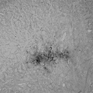 Runx3 Antibody in Immunohistochemistry (Paraffin) (IHC (P))