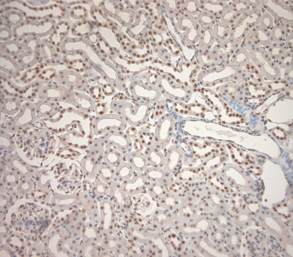 Ribeye Antibody in Immunohistochemistry (Paraffin) (IHC (P))