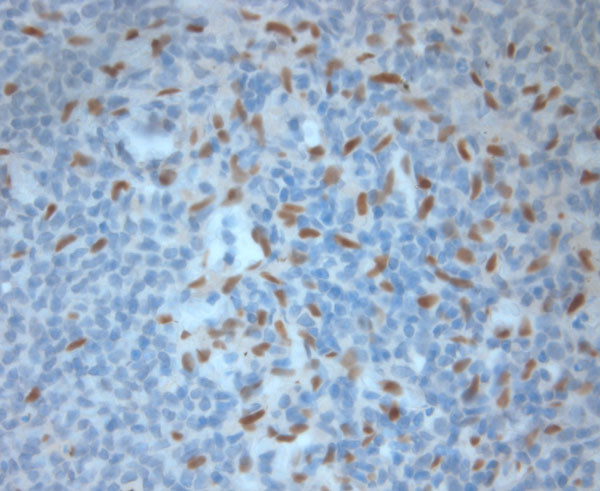 Ribeye Antibody in Immunohistochemistry (Paraffin) (IHC (P))