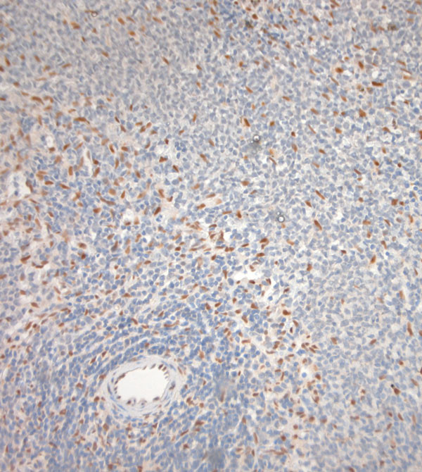 Ribeye Antibody in Immunohistochemistry (Paraffin) (IHC (P))