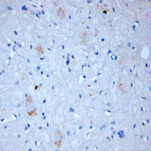 RAB4B Antibody in Immunohistochemistry (Paraffin) (IHC (P))