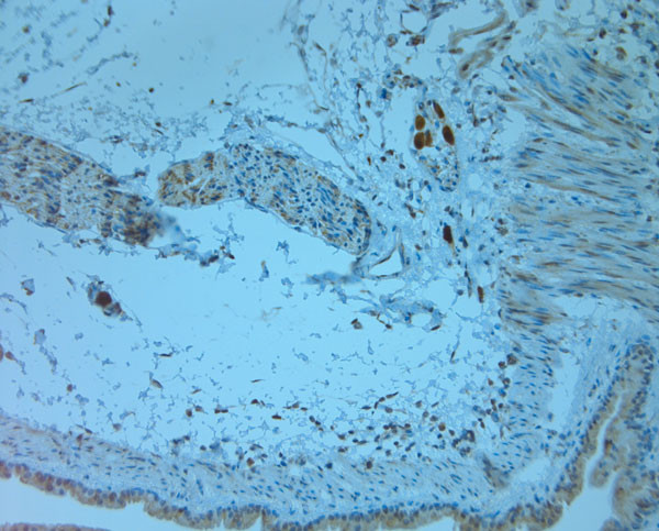 RGMC Antibody in Immunohistochemistry (Paraffin) (IHC (P))