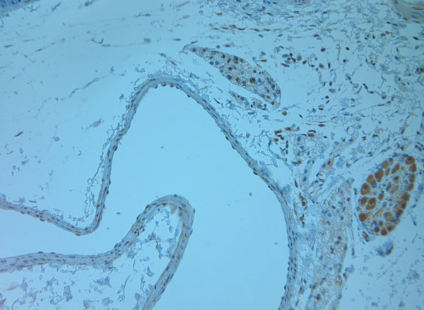 RGMC Antibody in Immunohistochemistry (Paraffin) (IHC (P))