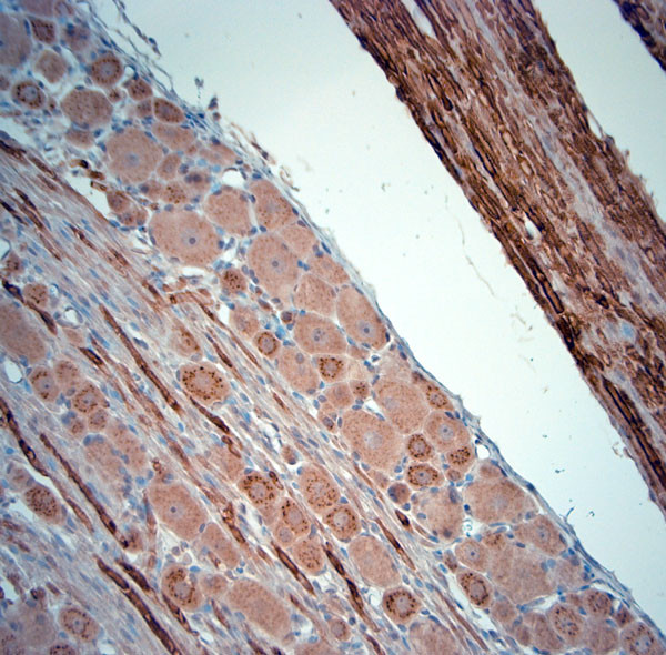 RYR1 Antibody in Immunohistochemistry (Paraffin) (IHC (P))