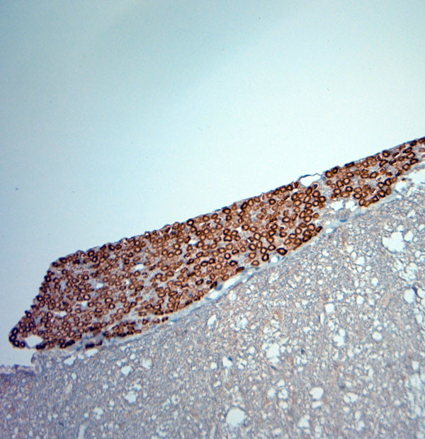 RYR1 Antibody in Immunohistochemistry (Paraffin) (IHC (P))