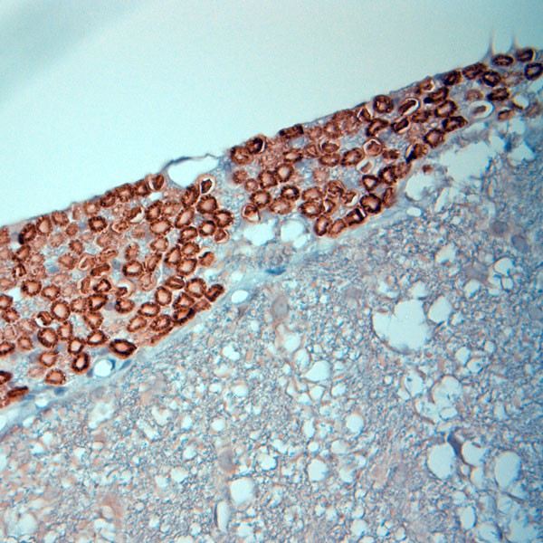 RYR1 Antibody in Immunohistochemistry (Paraffin) (IHC (P))