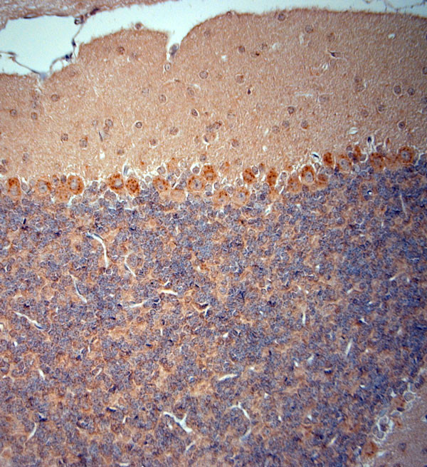 RYR1 Antibody in Immunohistochemistry (Paraffin) (IHC (P))