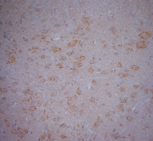 RYR1 Antibody in Immunohistochemistry (Paraffin) (IHC (P))