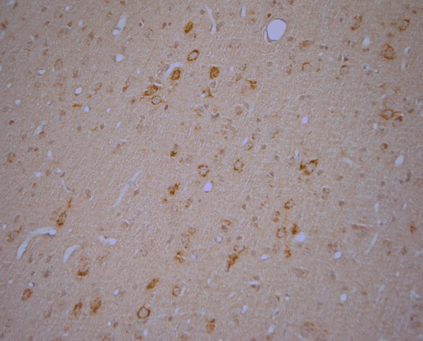 RYR1 Antibody in Immunohistochemistry (Paraffin) (IHC (P))