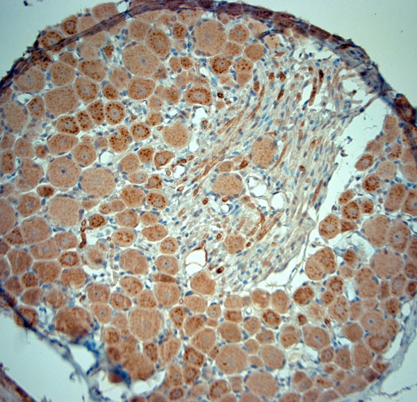 RYR1 Antibody in Immunohistochemistry (Paraffin) (IHC (P))