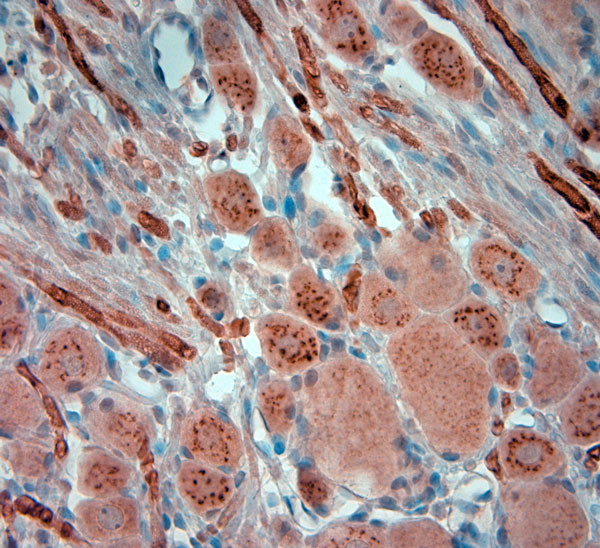 RYR1 Antibody in Immunohistochemistry (Paraffin) (IHC (P))