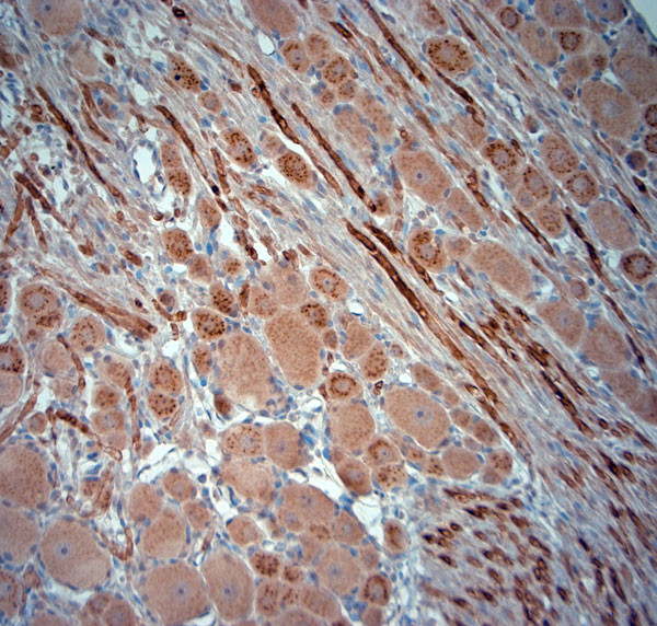 RYR1 Antibody in Immunohistochemistry (Paraffin) (IHC (P))