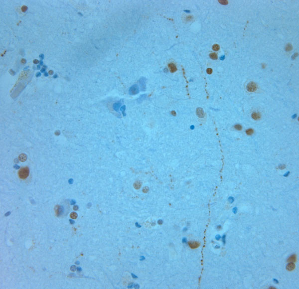 REEP6 Antibody in Immunohistochemistry (Paraffin) (IHC (P))