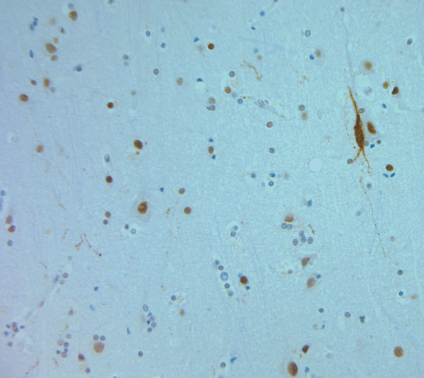 REEP6 Antibody in Immunohistochemistry (Paraffin) (IHC (P))