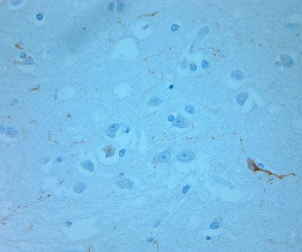 REEP6 Antibody in Immunohistochemistry (Paraffin) (IHC (P))