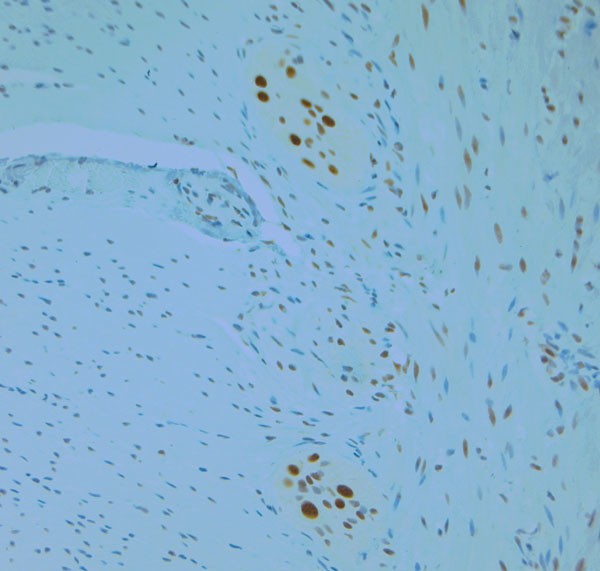 REEP6 Antibody in Immunohistochemistry (Paraffin) (IHC (P))