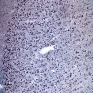 Sortilin Antibody in Immunohistochemistry (IHC)