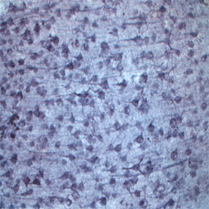 Sortilin Antibody in Immunohistochemistry (IHC)