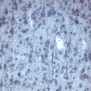 Sortilin Antibody in Immunohistochemistry (IHC)