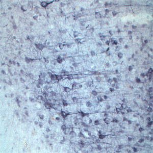 Sortilin Antibody in Immunohistochemistry (IHC)