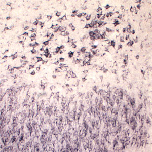 Sortilin Antibody in Immunohistochemistry (IHC)