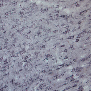 Sortilin Antibody in Immunohistochemistry (IHC)