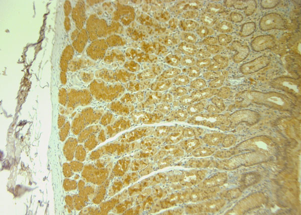 Syntaxin12 Antibody in Immunohistochemistry (Paraffin) (IHC (P))