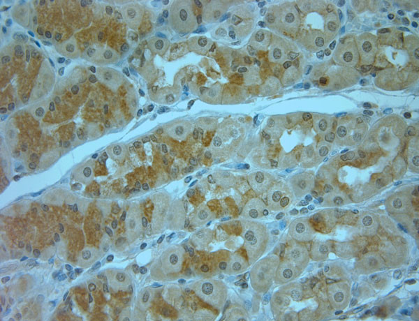 Syntaxin12 Antibody in Immunohistochemistry (Paraffin) (IHC (P))