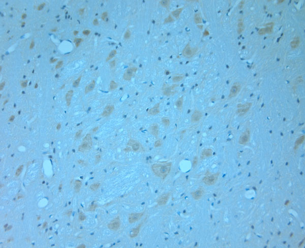 Synaptotagmin 1 Antibody in Immunohistochemistry (Paraffin) (IHC (P))