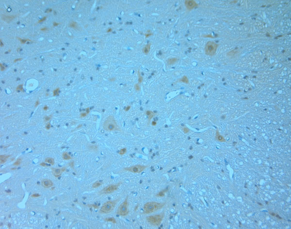 Synaptotagmin 1 Antibody in Immunohistochemistry (Paraffin) (IHC (P))